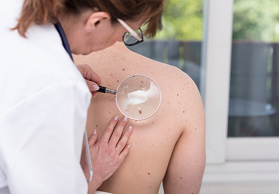 Skin Conditions